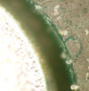 Figure 3. Solder ball on the edge of the mask and after removal to show the surface of the mask and the flux ring. Surface analysis of the mask surface after ball removal can show surface damage and also tin oxide in the surface layer